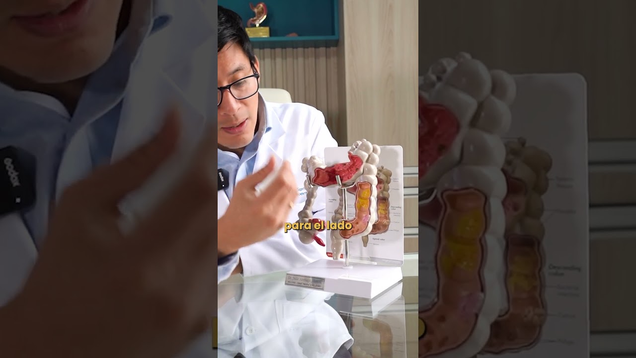 abdomen tipo de dolores de estomago