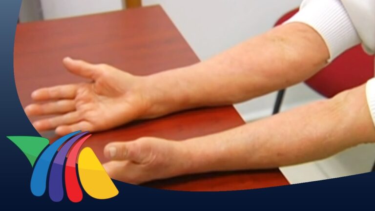 alergia en la piel por estres