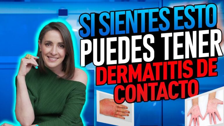 alergia en las manos por estres