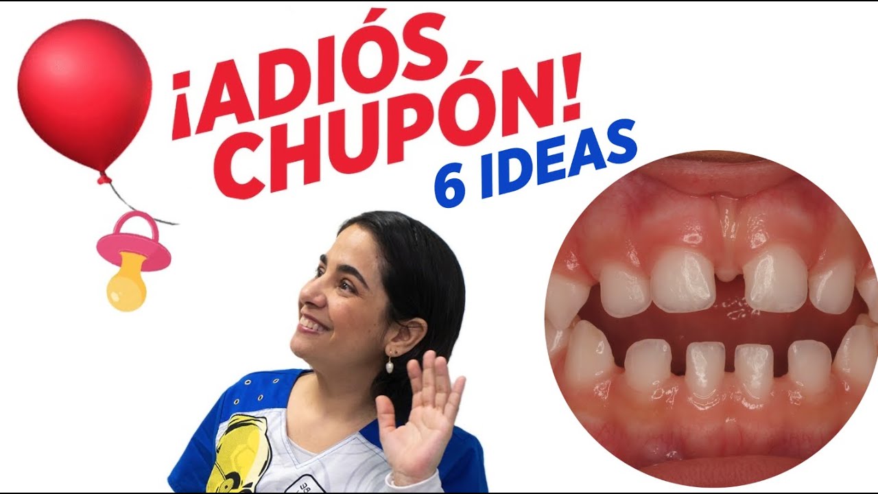 como quitar el chupete a un niño de 3 años