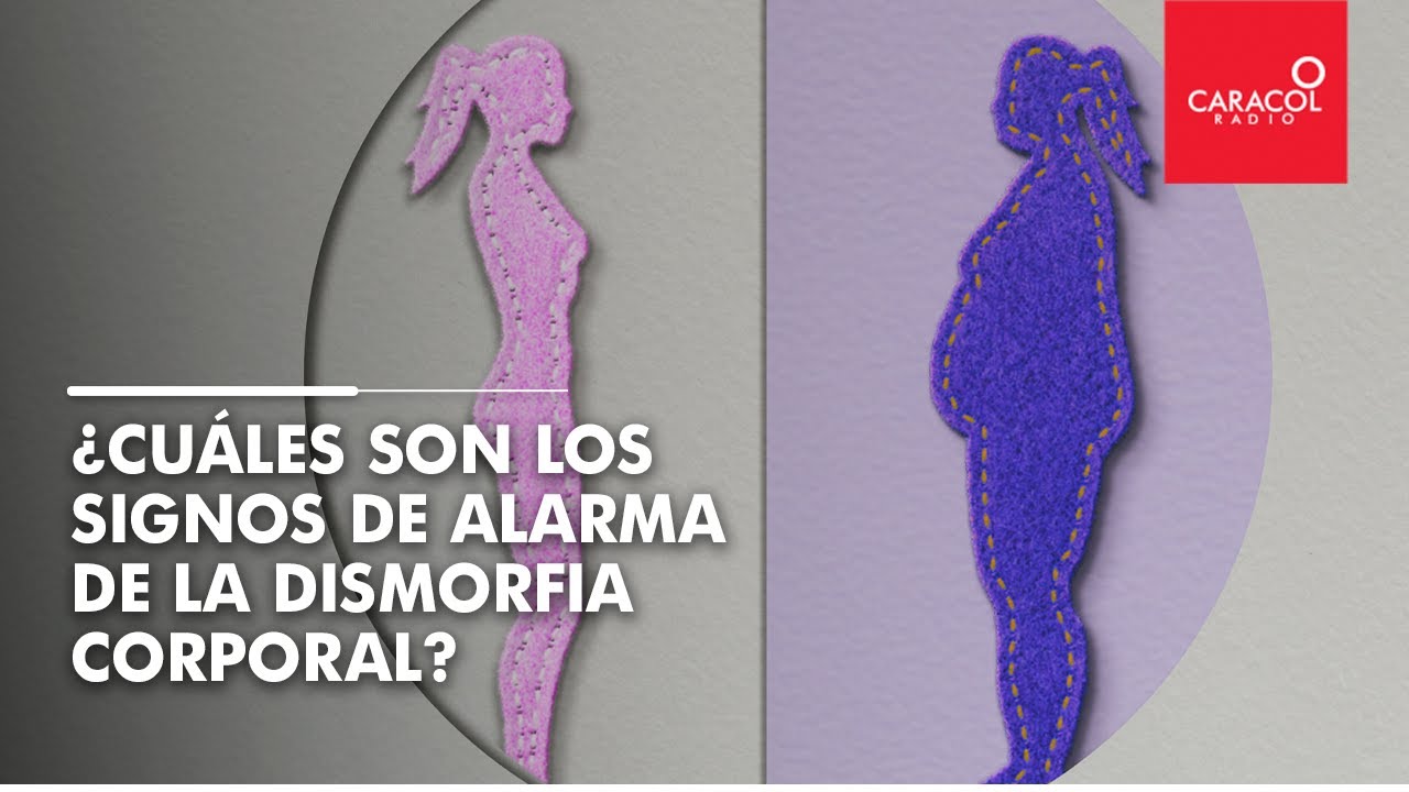 como saber si tengo dismorfia corporal