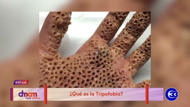 como se llama la fobia a los pies