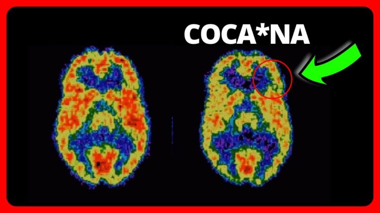 cuanto dura los sintomas de abstinencia