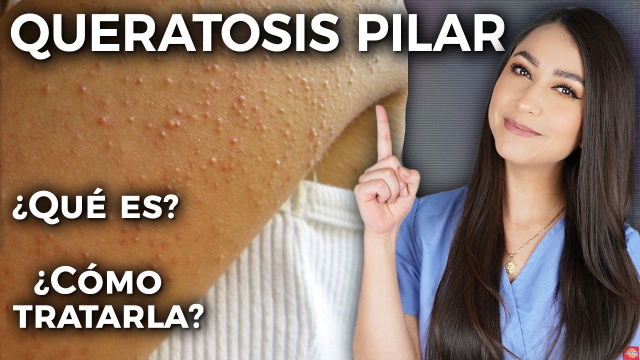 granitos en los brazos por estrés