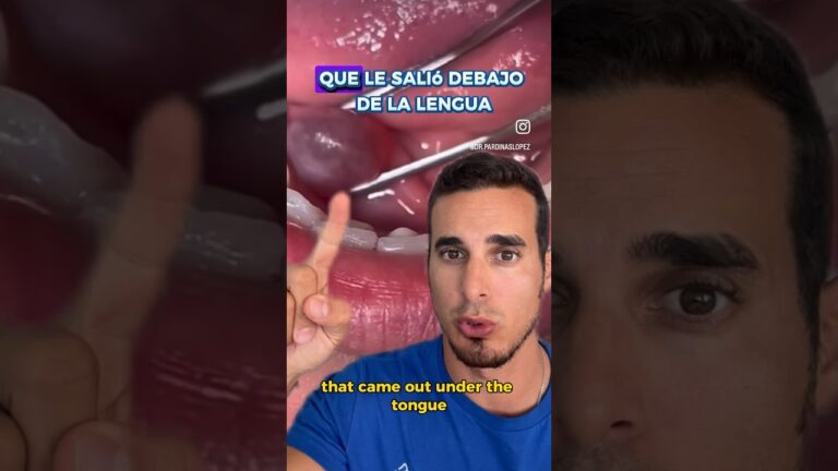 inflamación debajo de la lengua