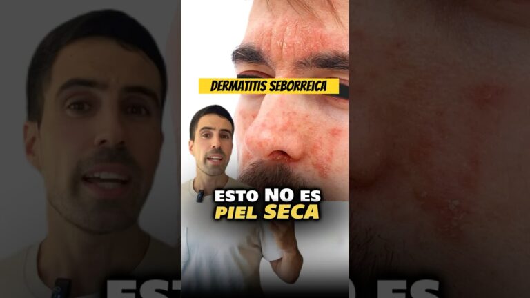 la descamación de la piel