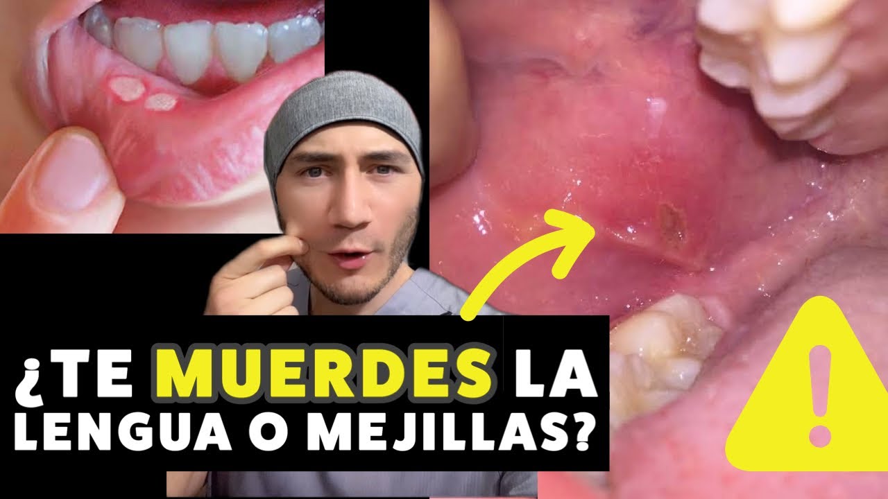 morderse la boca por dentro sin querer biodescodificación