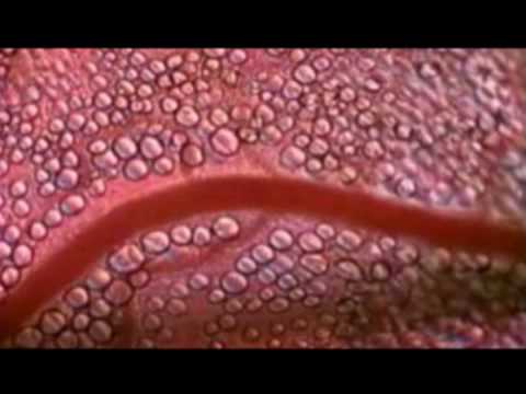 nudo en el estomago sintomas