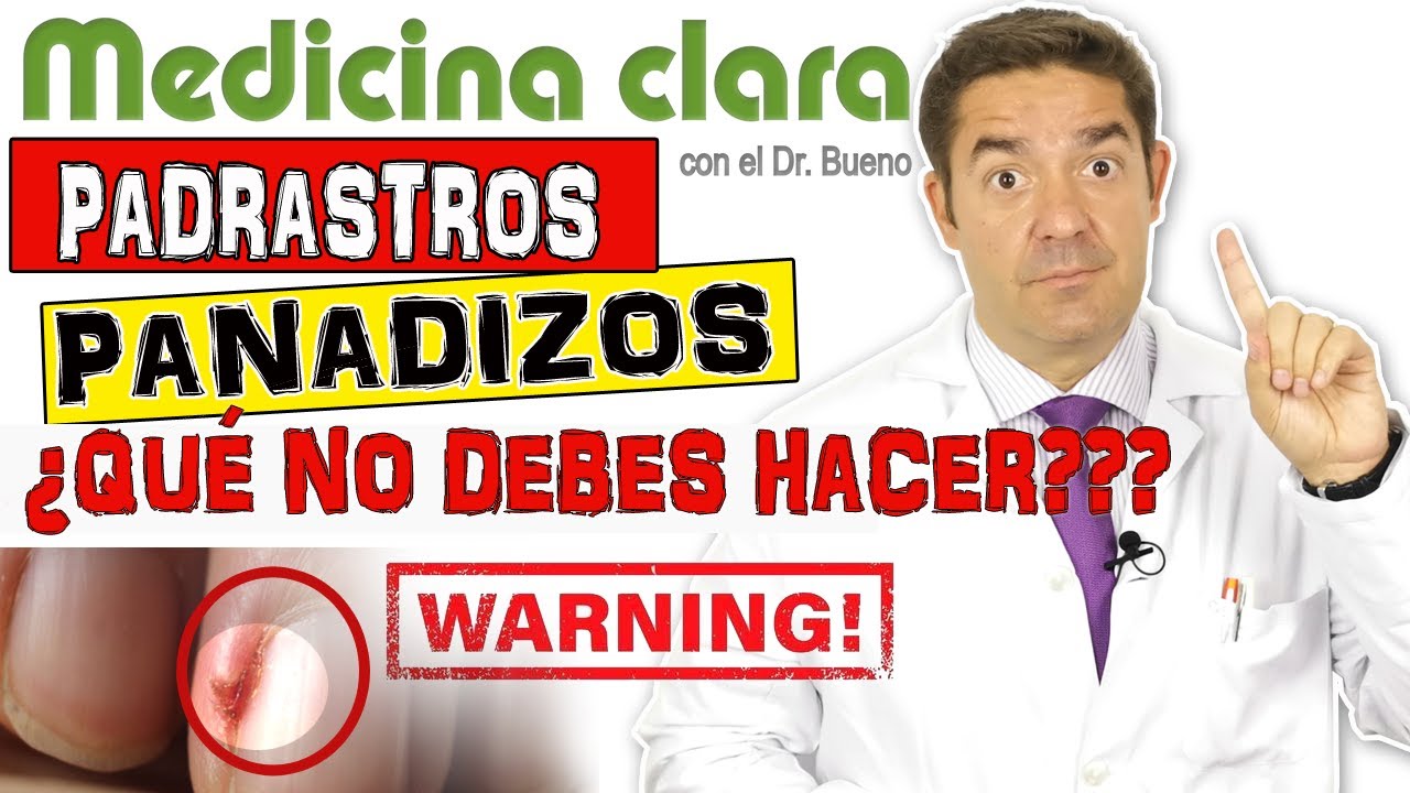 porque salen los padrastros en los dedos