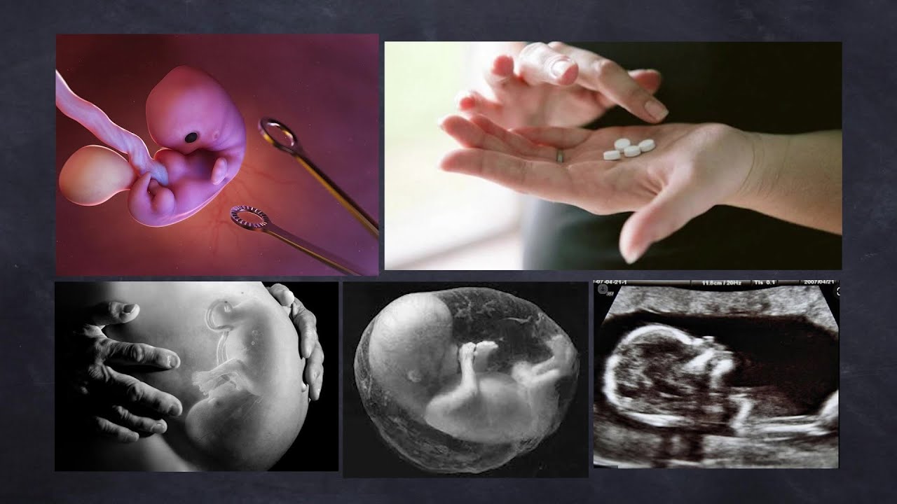 secuelas de un aborto voluntario