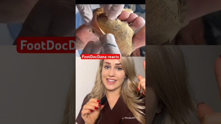 tripofobia en la piel es real