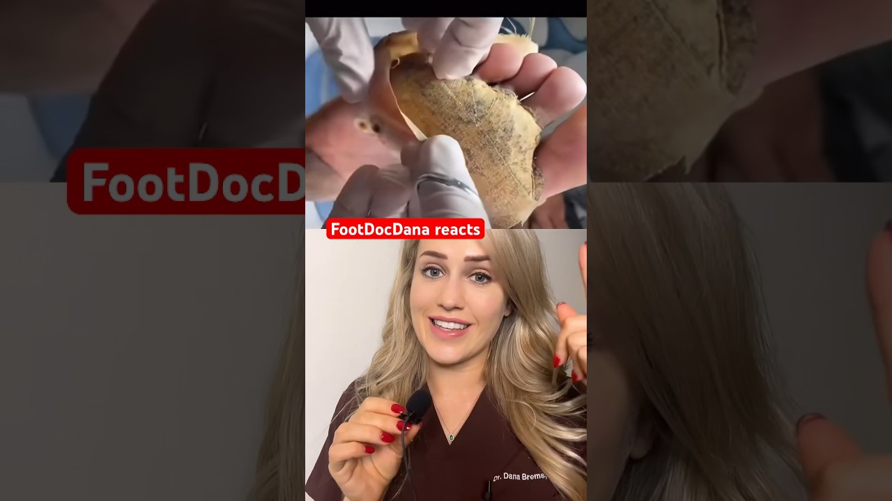 tripofobia en la piel es real